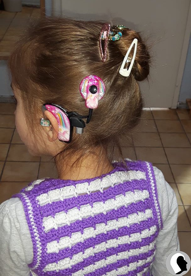 CI Kopf 2018 weiblich Kind